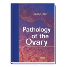 PATHOLOGY OF THE OVARY