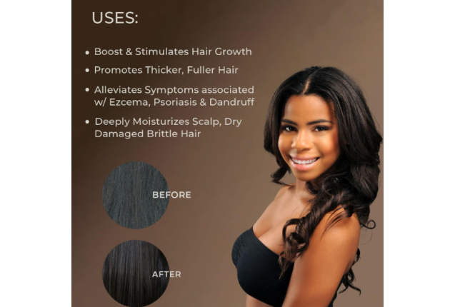 Sunny Isle Extra Dark Jamaican Black Castor Oil – 4 oz Pure Organic Growth & Moisture Treatment x 6