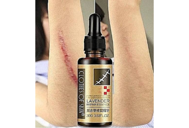 Clothes of Skin Lavender Repair Essence - Effective Scar remover and Stretch Marks