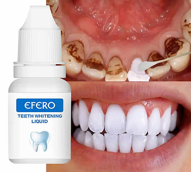 EFERO Teeth Whitening Essence 