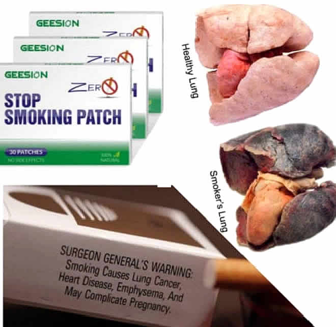 GESSION Stop Smoking Patch (20
