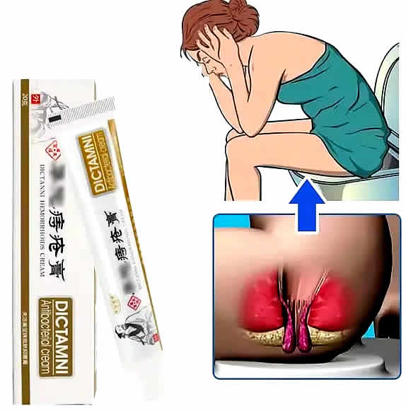 Dictamni Hemorrhoids Ointment 
